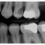 Thumb_90_dental-digital-x-ray