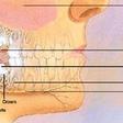 Thumb_112_wisdom-teeth-extraction